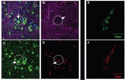 Descripción de la imagen. En el cerebro de los ratones con Alzheimer, aparecen áreas cercanas a las placas amiloides (A) con menos redes neuronales (B), neuronas moribundas (C) y mayor OCIAD1 (D). En las células neuronales cultivadas, las proteínas OCIAD1 (E) aparecen en las mitocondrias (F).